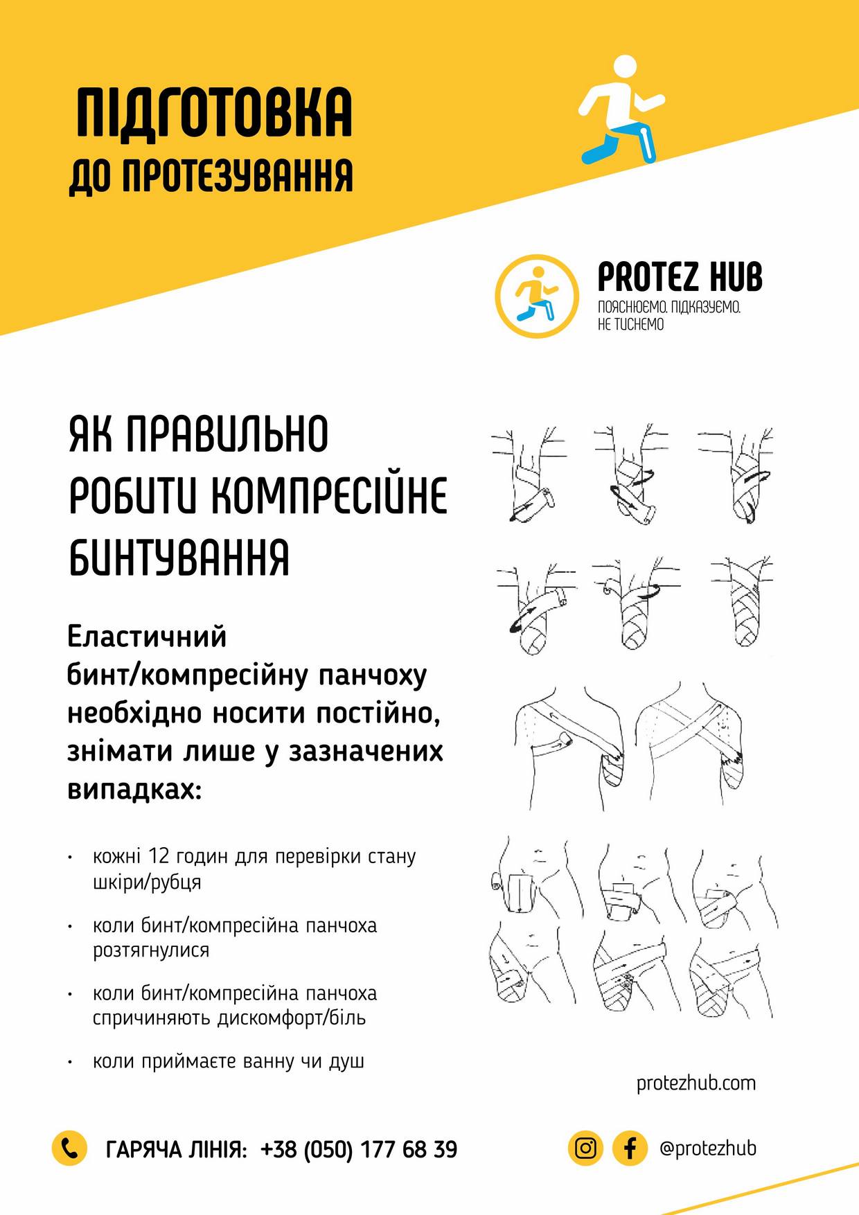 Підготовка до протезування